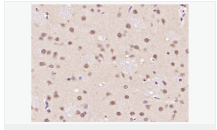 6058357793d3f.png image.png