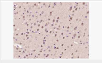 6058357dbda04.png image.png