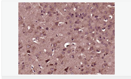 605838b02e222.png image.png