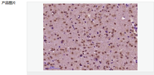 6058540894b5d.png image.png