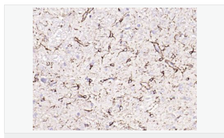 60612c008c619.png image.png