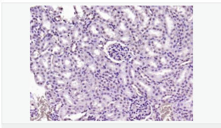 606531e29332e.png image.png